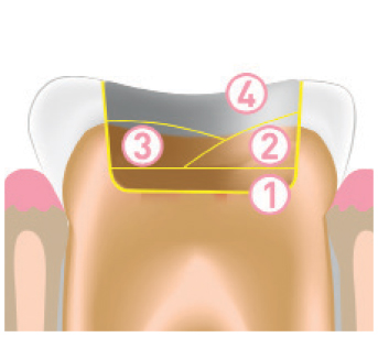 Jendental Ukraine jen radiance molar traditional tech